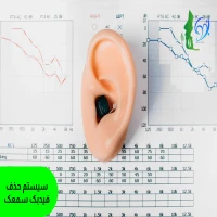 سیستم حذف فیدبک سمعک